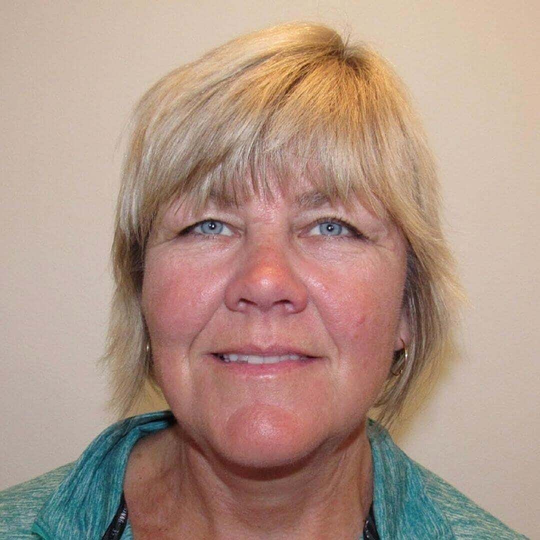 Facelift And Neck Lift Before & After